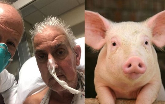 EUA: Homem se recupera após transplante com coração de porco