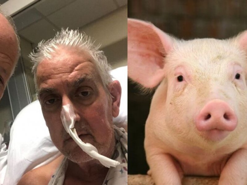EUA: Homem se recupera após transplante com coração de porco