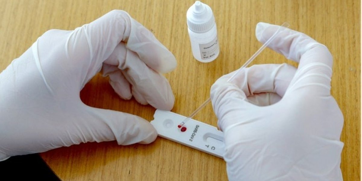 Covid: Municípios baianos vão receber 340 mil testes rápidos