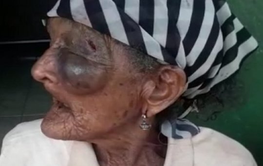 Idosa é assaltada e espancada por homem na cidade de Iaçu, na Bahia