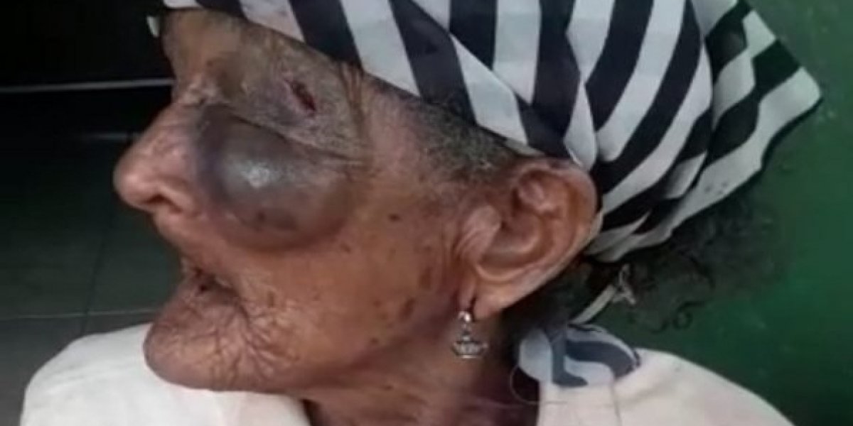 Idosa é assaltada e espancada por homem na cidade de Iaçu, na Bahia