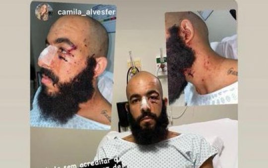 Esposa de Danilo Fernandes mostra fotos do jogador após ataque a ônibus 