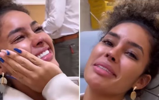 Sthe Matos mostra resultado de terceira cirurgia no nariz