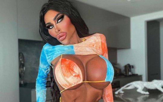 Australiana realiza diversas cirurgias plásticas para virar 'Barbie humana'