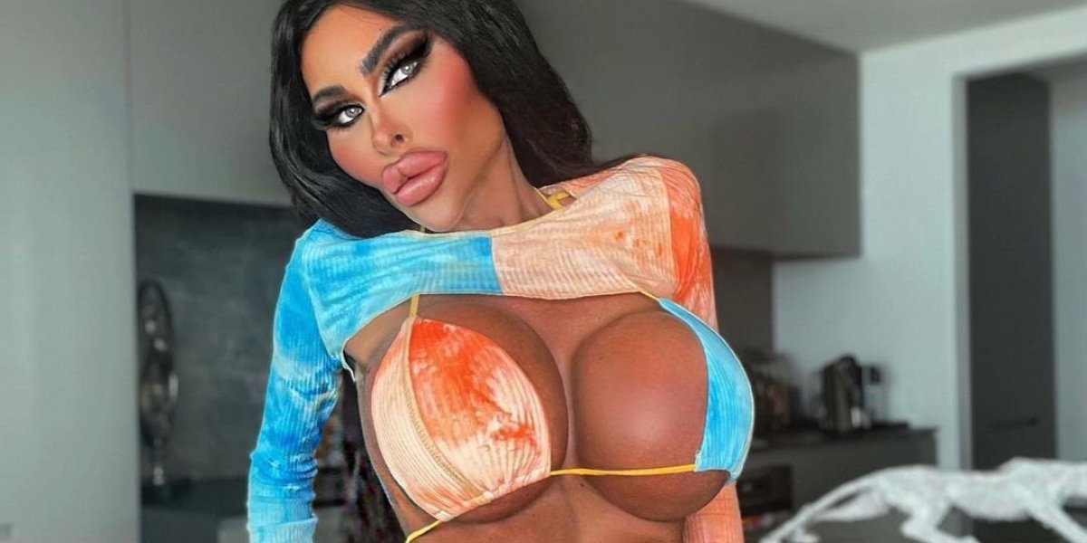 Australiana realiza diversas cirurgias plásticas para virar 'Barbie humana'