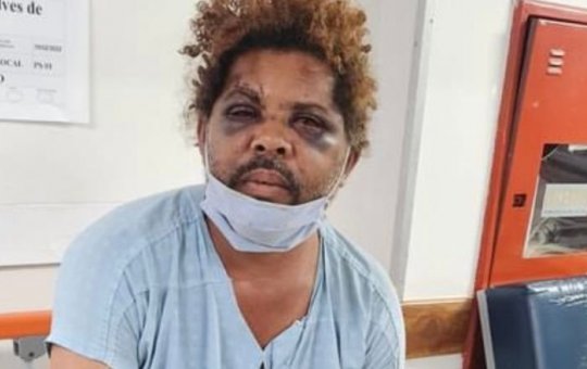 Vídeo mostra personal espancando mendigo nu em novo ângulo; Veja