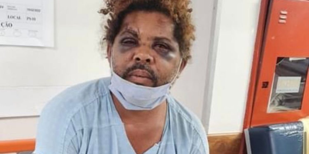 Vídeo mostra personal espancando mendigo nu em novo ângulo; Veja