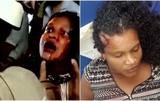 Indígena agredida por PMs passa mal e é internada em hospital no sul da Bahia