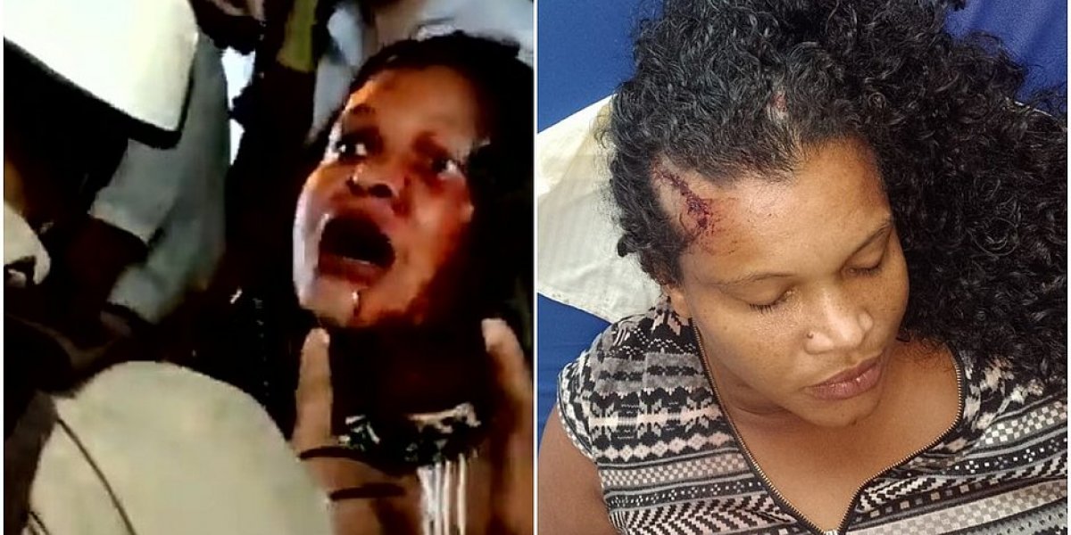 Indígena agredida por PMs passa mal e é internada em hospital no sul da Bahia