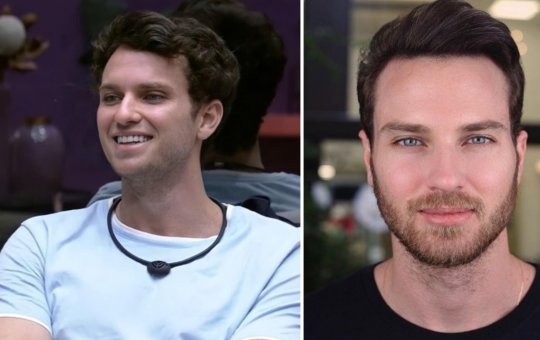 Ex-BBB Lucas Bissoli exibe transformação facial nas redes sociais