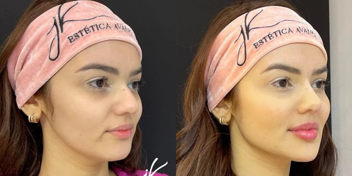 Eslovênia desembolsa R$ 70 mil em procedimentos estéticos