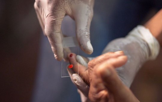 Ministério da Saúde quer zerar casos de malária no Brasil até 2035