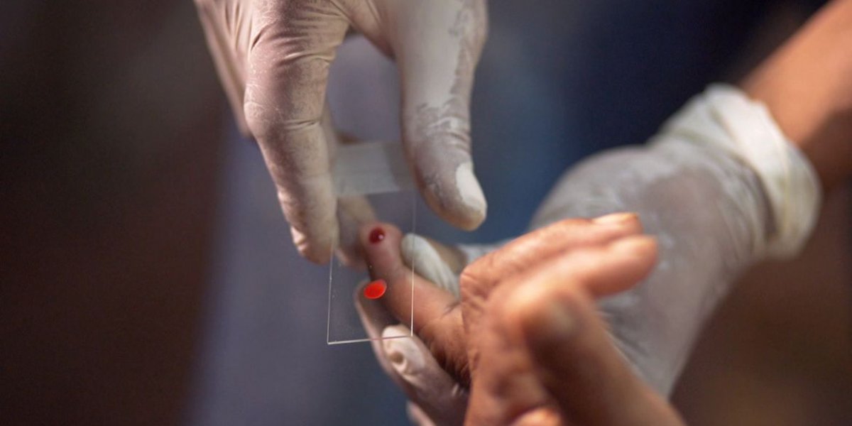 Ministério da Saúde quer zerar casos de malária no Brasil até 2035