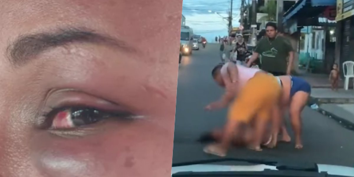 Cenas Fortes: Mulher grávida é agredida por três pessoas no meio da rua