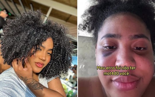 Influencer baiana denuncia agressões de ex-namorado