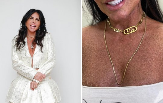 Gretchen assume os pelos e debocha das críticas feitos à seu visual natural