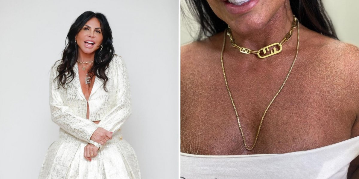 Gretchen assume os pelos e debocha das críticas feitos à seu visual natural