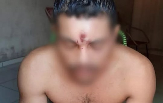 Em Tocantins, jovem leva tiro na testa volta para casa e vai dormir