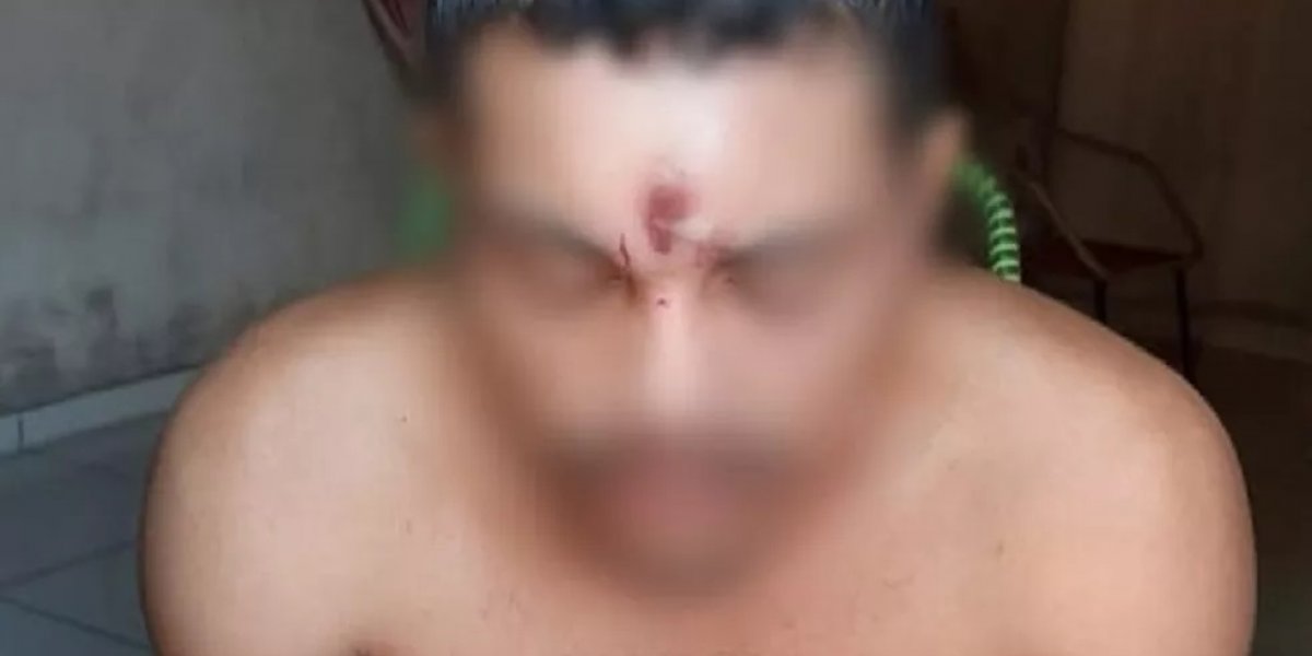Em Tocantins, jovem leva tiro na testa volta para casa e vai dormir
