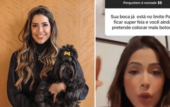 Ex-BBB Laís rebate críticas sobre preenchimento; "Se for necessário coloco mais"