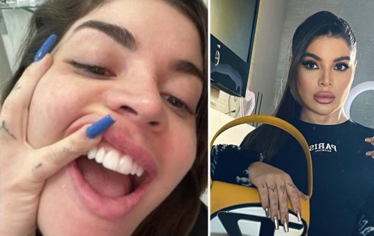 "Ficou mais caro beijar minha boca"; Gkay ousa e implanta diamante no dente