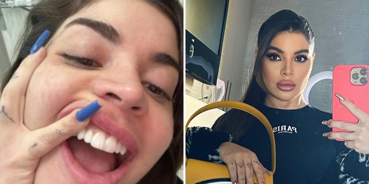 "Ficou mais caro beijar minha boca"; Gkay ousa e implanta diamante no dente