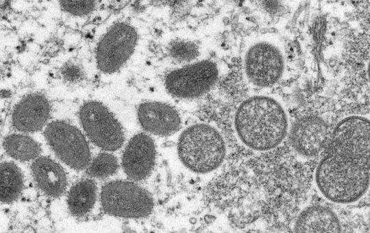 Ministério da Saúde confirma sétimo caso de varíola dos macacos no país