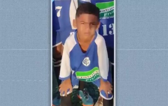 Após cair de janela em Itabuna, menino de 5 anos passa por cirurgia no crânio