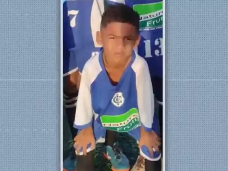 Após cair de janela em Itabuna, menino de 5 anos passa por cirurgia no crânio