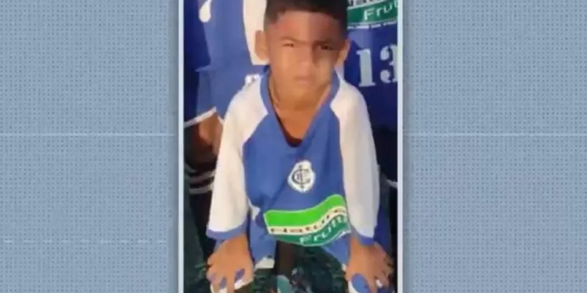 Após cair de janela em Itabuna, menino de 5 anos passa por cirurgia no crânio