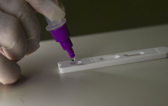 Covid-19: Brasil registra 266 óbitos e 77,1 mil casos em 24 horas