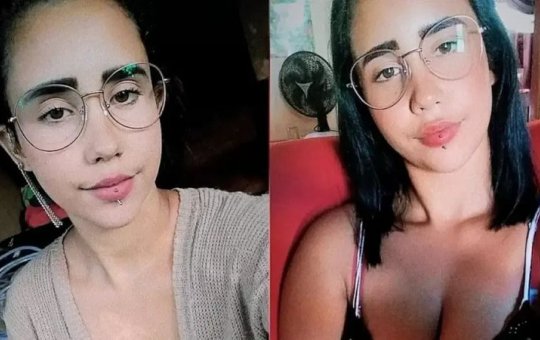 Jovem morre após furo de piercing na boca inflamar e causar infecção no cérebro