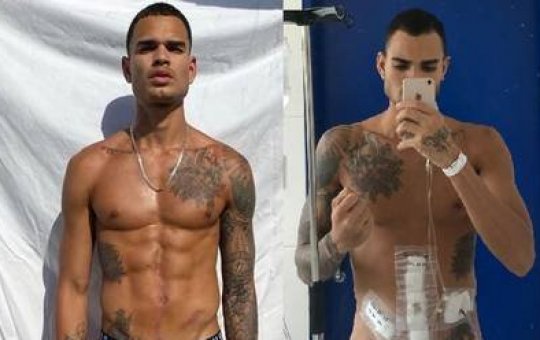 Modelo carioca é esfaqueado na Turquia e perde parte do intestino