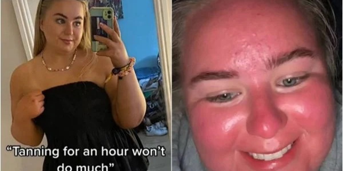 Mulher aparece com rosto inchado após onda de calor atingir o Reino Unido