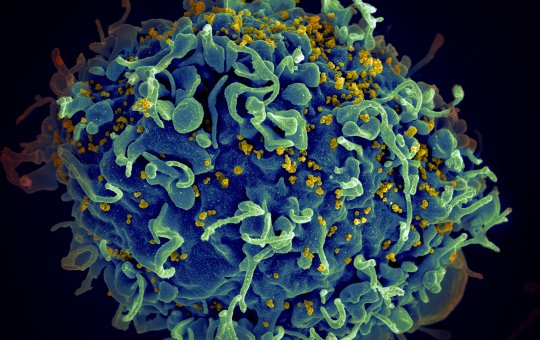 Paciente é curado do HIV nos Estados Unidos; Este é o quarto caso no mundo