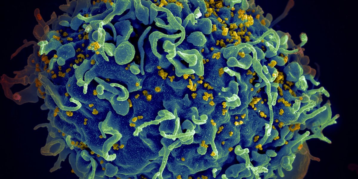 Paciente é curado do HIV nos Estados Unidos; Este é o quarto caso no mundo