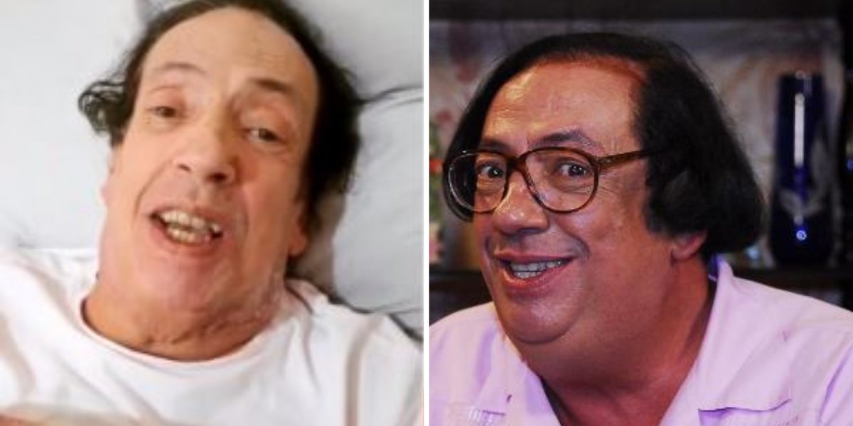 "Tenho que comer"! Marcos Oliveira, o Beiçola, volta a pedir ajuda após cirurgia