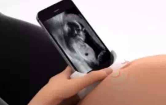 Gestantes poderão assistir crescimento do feto por ultrassom no celular