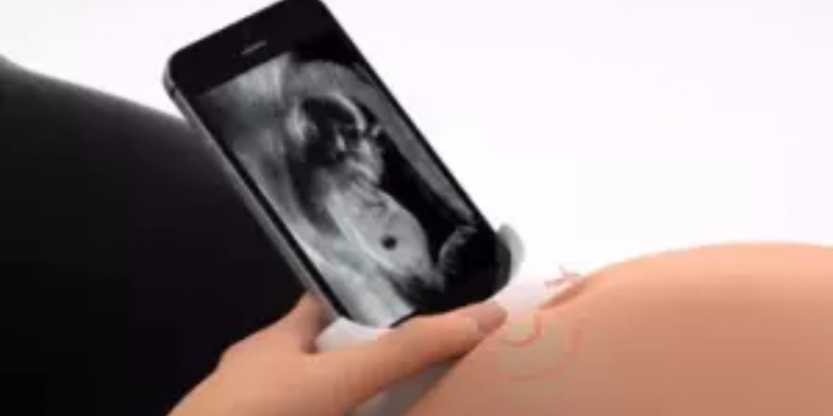 Gestantes poderão assistir crescimento do feto por ultrassom no celular