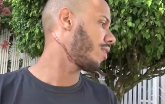 Motociclista sofre lesão no pescoço após atingir fiação baixa no sul da BA