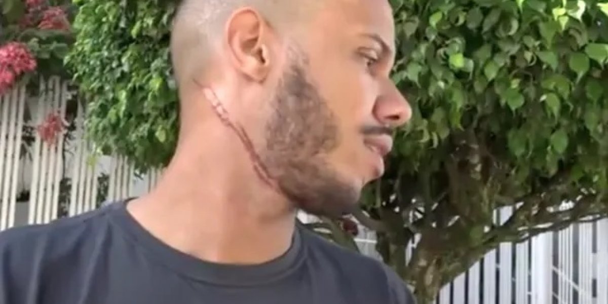 Motociclista sofre lesão no pescoço após atingir fiação baixa no sul da BA