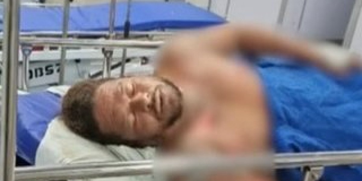 Acusado de atear fogo em companheira na Boca do Rio morre no HGE