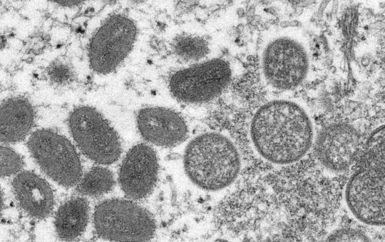 Ao todo, Bahia registra 39 casos de varíola dos macacos, 30 deles em Salvador