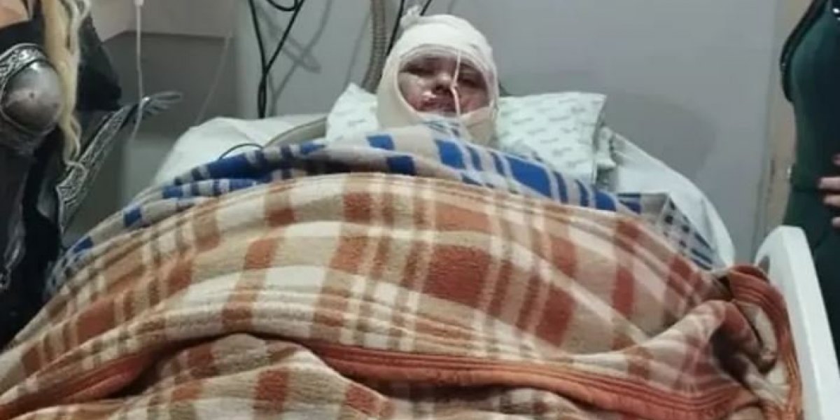 Mulher acorda do coma, conta que marido ateou fogo nela e depois morre