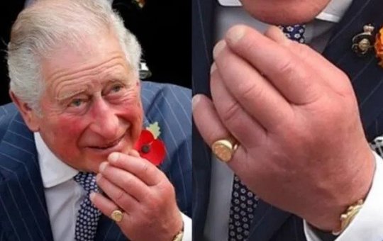 Médico explica motivo do inchaço dos 'dedos de salsicha' do Rei Charles: entenda