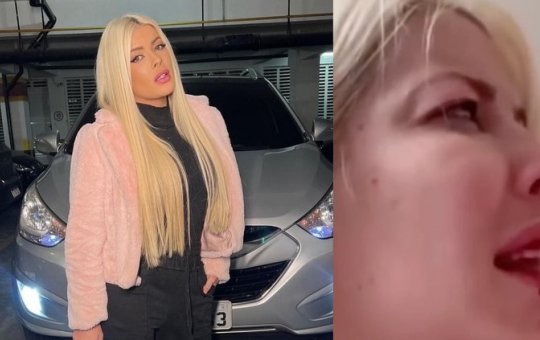 Ex-BBB Jaqueline aparece aos gritos, chorando com machucado na boca: "sai daqui"