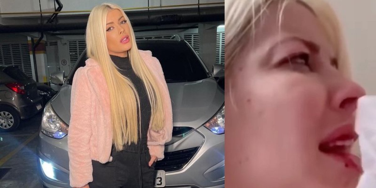 Ex-BBB Jaqueline aparece aos gritos, chorando com machucado na boca: "sai daqui"