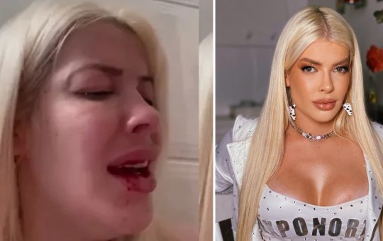 Ex-BBB Jaquelline Grohalski é agredida pelo namorado: ‘Medidas sendo tomadas’