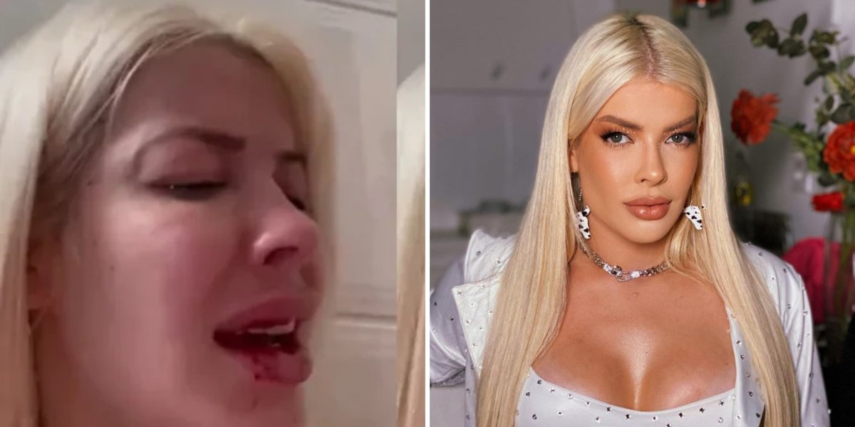 Ex-BBB Jaquelline Grohalski é agredida pelo namorado: ‘Medidas sendo tomadas’