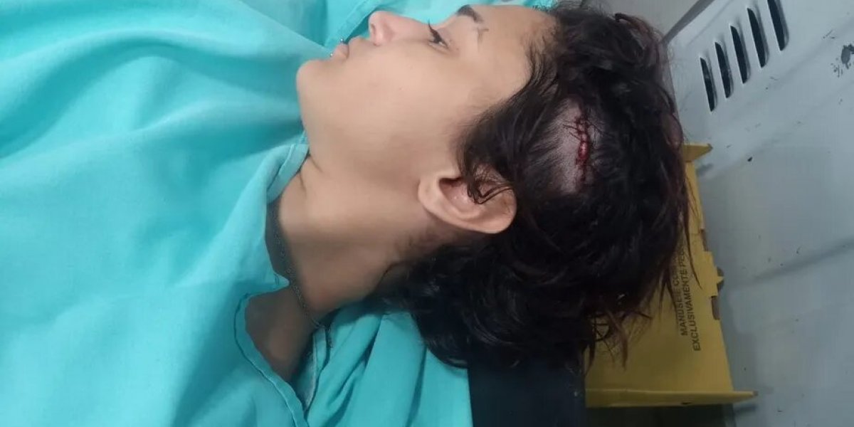 Jovem é agredida em bar após criticar Bolsonaro